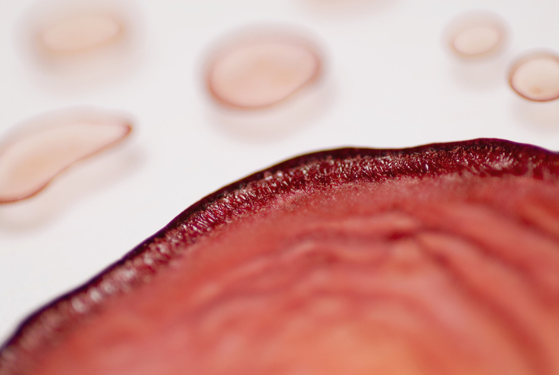 红细胞低饮食应该注意哪些事项,红细胞低怎么治