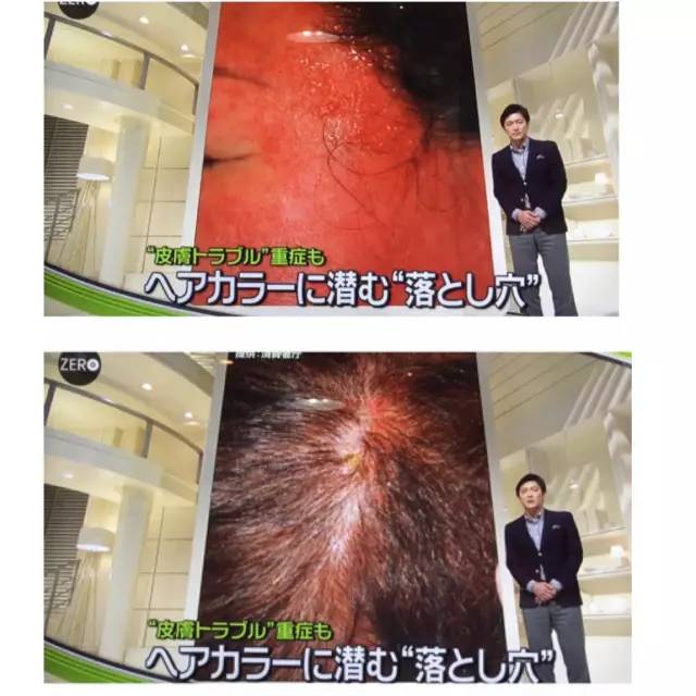 日本最安全的染发,日本一次性染发有没有危害