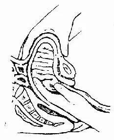 纱布门事件真相,纱布门事件新闻