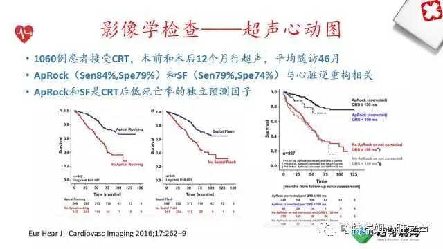 「心声」从机制到临床，一起认识左束支阻滞！