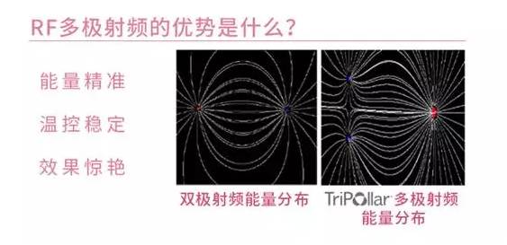 兔妈分享丨价格好爆！以色列Tripollarstop童颜机Luna洁面仪电动硅胶牙刷，吃土都值得入！