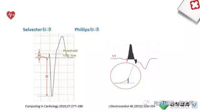 「心声」从机制到临床，一起认识左束支阻滞！