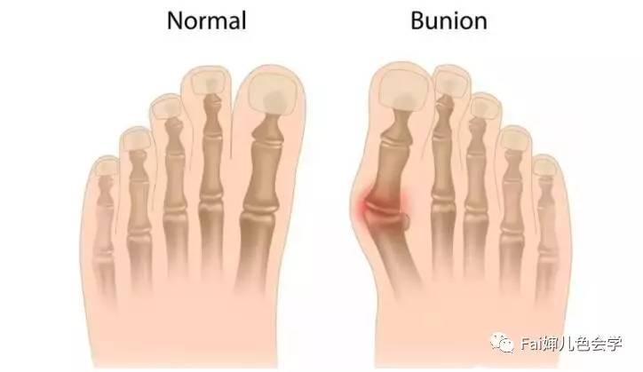 不吃藕|恋足癖都嫌弃你的脚,你好意思吗~