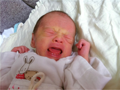 刚出生的宝宝长什么样?这里五大现象,看得心发慌