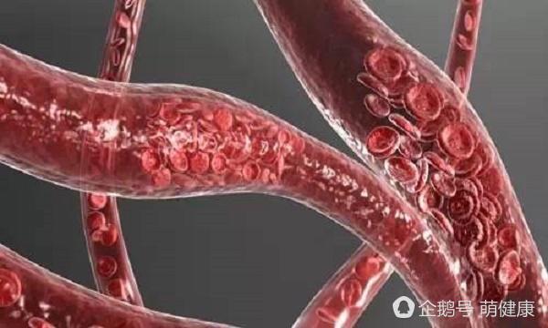 有这6种症状说明该休息了,有以下四种症状也可能是精神病