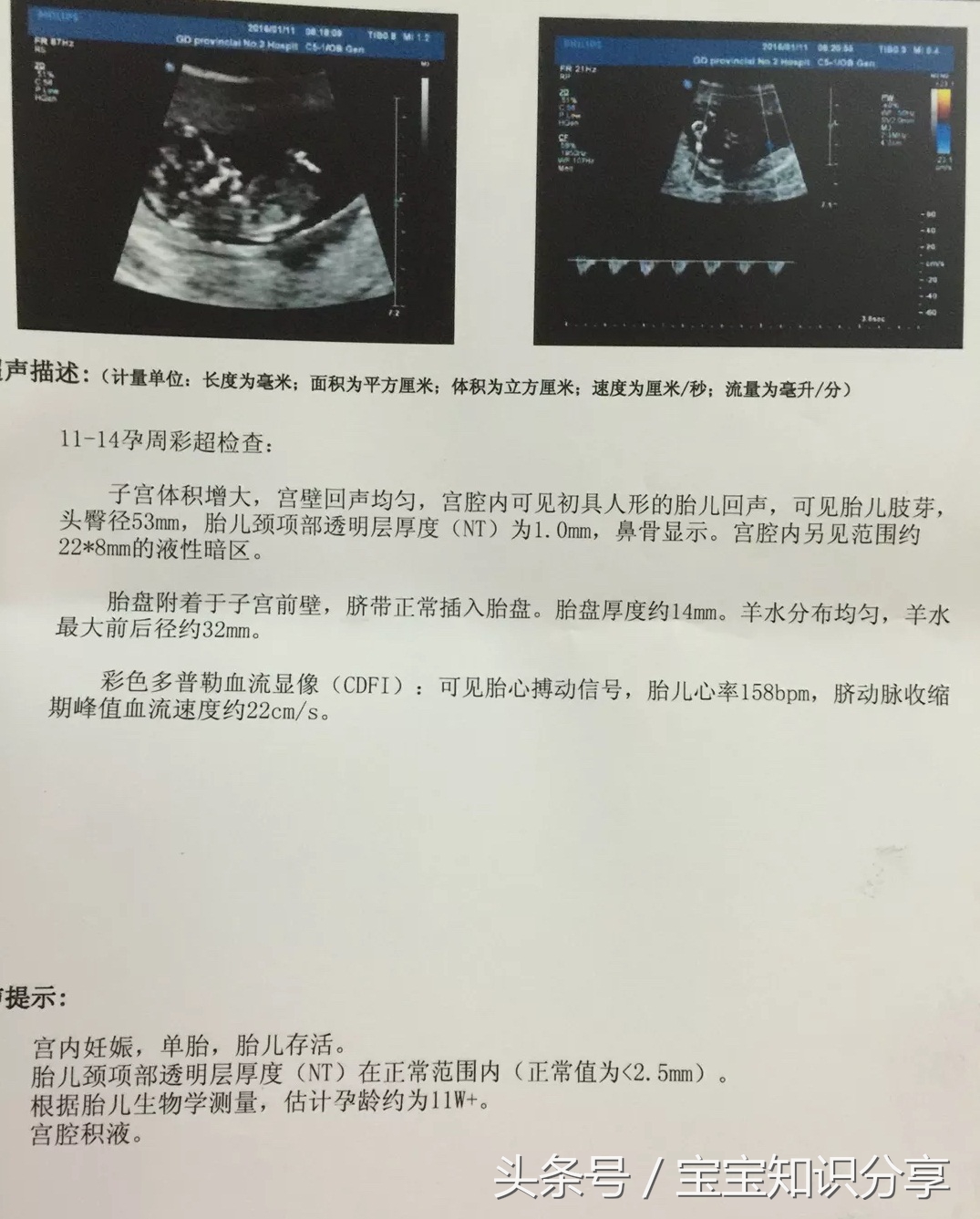 “男翻女”顺产助产士说“我可没儿子给你”把我逗笑了！这些都不准