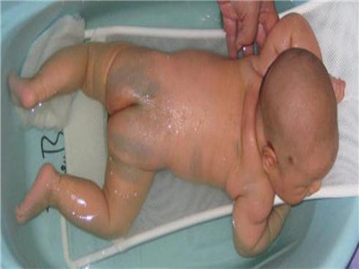 刚出生的宝宝长什么样?这里五大现象,看得心发慌