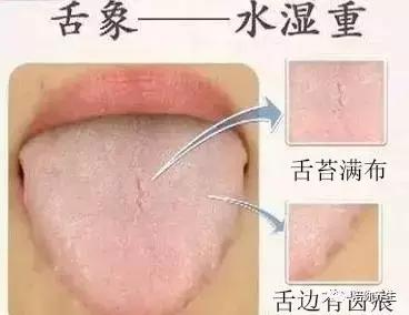 夏季下雨祛湿要吃15种食物,阴雨频繁湿气重4种食物助祛湿