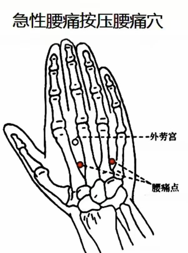 腰椎间盘突出反反复复腰痛怎么办,腰肌劳损腰疼和腰椎间盘突出