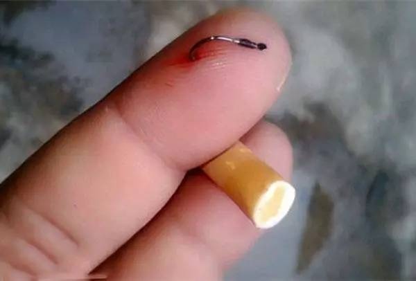 鱼钩倒刺刺进肉里怎么弄出来,有倒刺的鱼钩扎到肉如何取