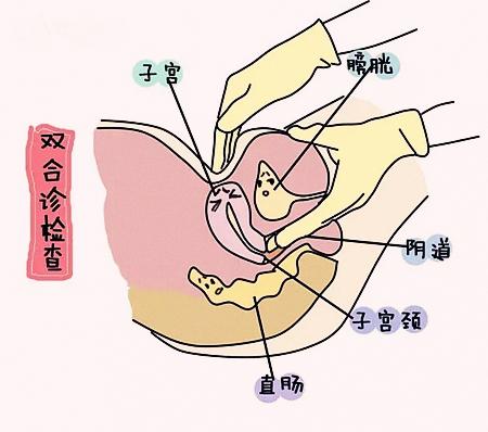 小玲每隔半年定期妇检，很少让爱人为自己担心，大家可以看看她的常规妇检项目