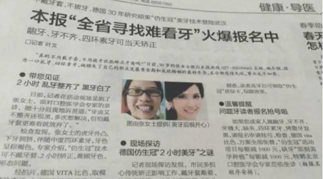 爱笑的人运气不会差牙齿黄,爱笑的人牙齿不好