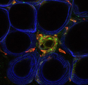 惊喜！Cell子刊：“30岁”的哮喘药或成糖尿病新疗法