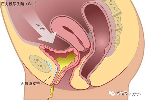 产后妈妈最想照顾好宝宝,生完宝宝妈妈最关心的是什么