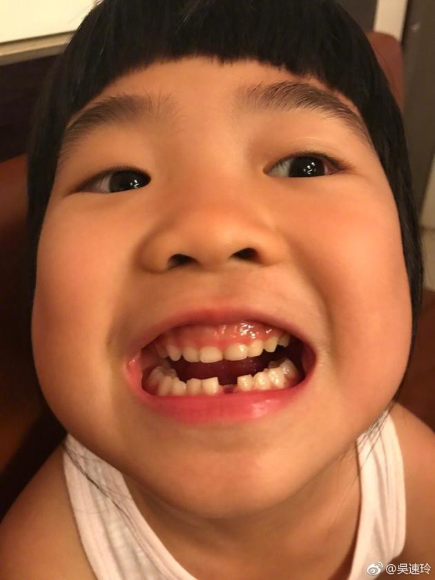 家有儿女森碟女大十八变,11岁森碟长大后图