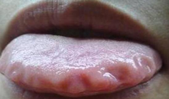 湿气重一招教你轻松解决湿气问题,湿气是百病源祛湿气一招搞定