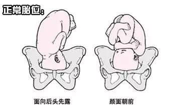 孕期胎位不正怎么调整,孕期胎位不正艾灸注意事项