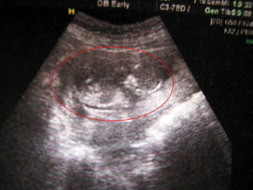 胎动可不是宝宝在随便乱蹬，其实宝宝是想和妈妈“说话”呢