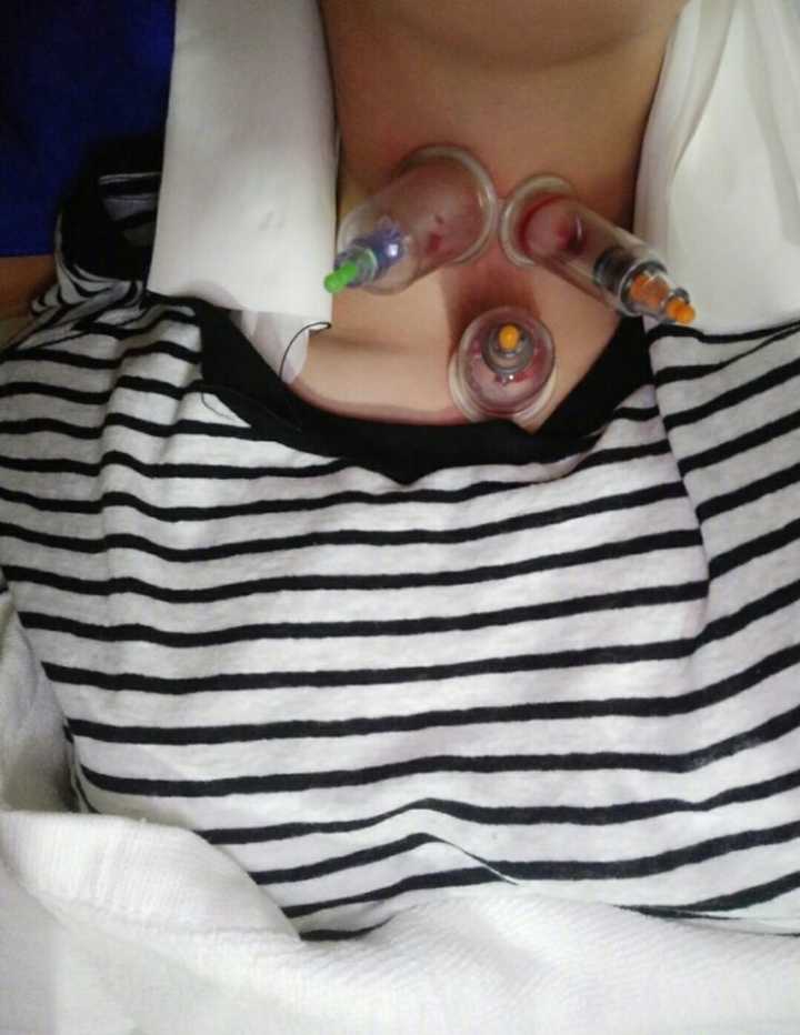 大幂幂干活不要命，生病以至要接受放血治疗，但又被媒体黑是什么梗，网友直逼媒体道歉