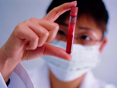 教你简单读懂化验单,教你简易看化验单