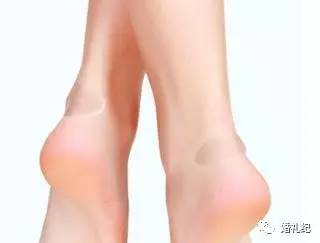 痛!有新娘把婚鞋买成了X鞋!