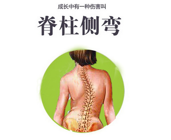 儿童轻微脊柱侧弯怎么矫正,儿童很多都有脊柱问题吗