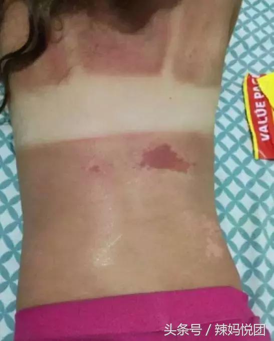 婴幼儿用什么防晒霜最安全,婴儿多大可以抹防晒霜