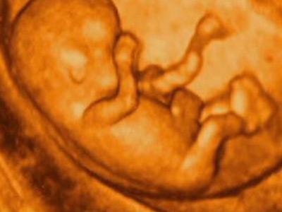 怎么根据胎儿大小估胎儿体重,哪个指标可以准确判断胎儿大小