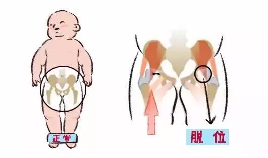 把尿,开裆裤,你要这样继续陋习多久?