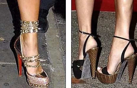 贝克汉姆的脚变形,贝克汉姆老婆脚外翻