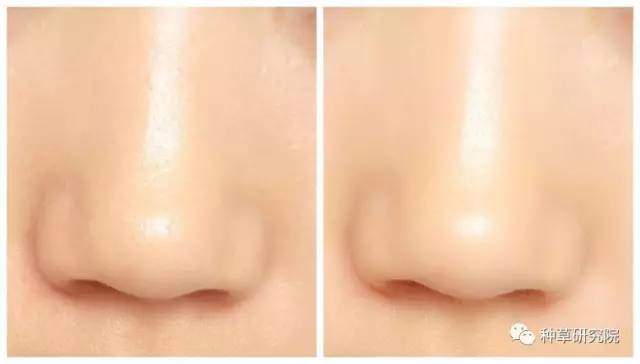 怎么让皮肤像剥壳鸡蛋一样光滑,怎么让皮肤滑的像鸡蛋