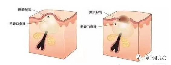 怎么才能让皮肤像水煮蛋样,怎样让皮肤像剥鸡蛋