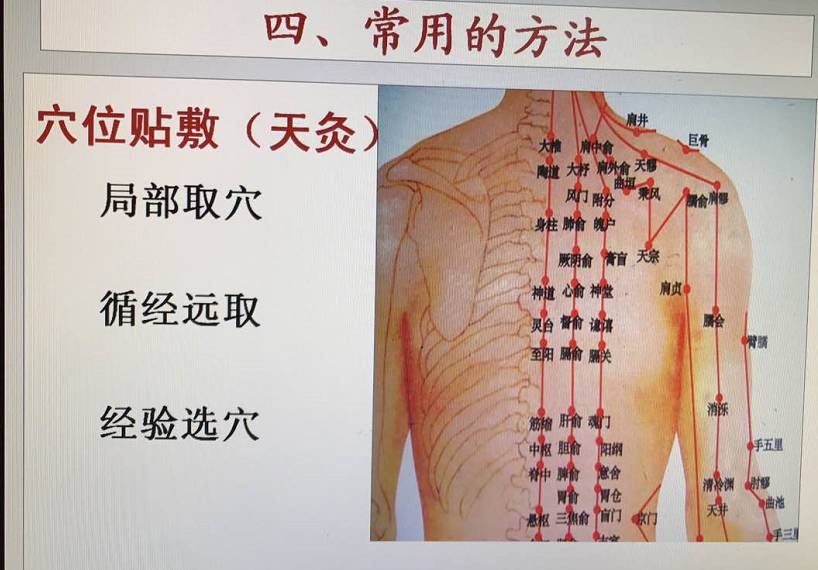三伏贴能自制吗?孩子能贴吗?选择哪些穴位贴?贵医附院专家为你详细解答