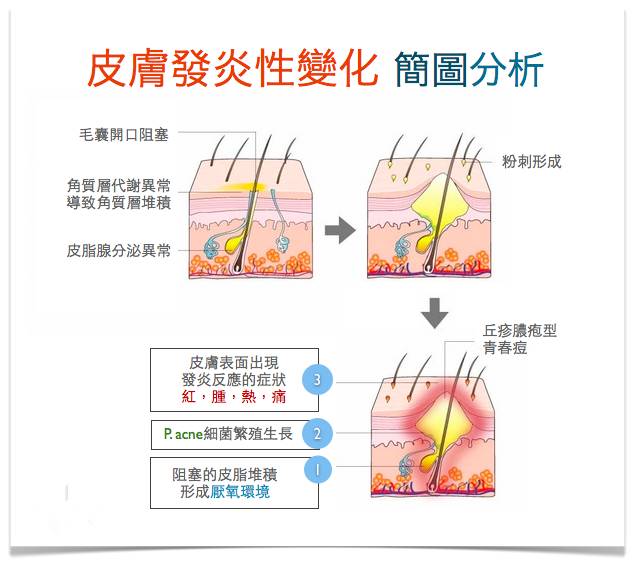 战痘大结局完整版,战痘合集完整版