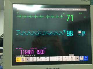 围手术期个案护理比赛优秀案例ppt,术后镇痛的规范化管理ppt