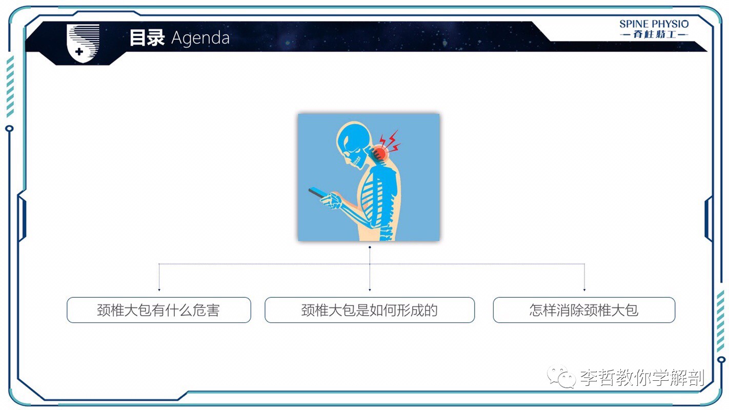 24度颈部大包怎么去除,颈后大包通过训练消除