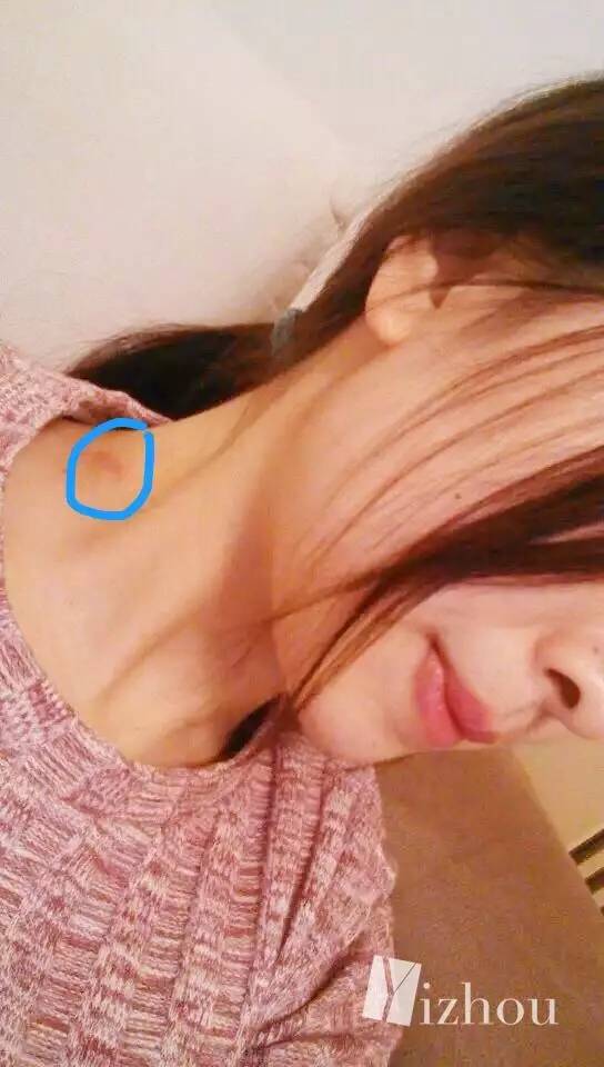 最便宜的护肤药膏,10块钱的药和100元的药