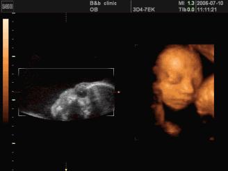 b超发现某些问题一定要处理么,b超发现问题需要处理吗