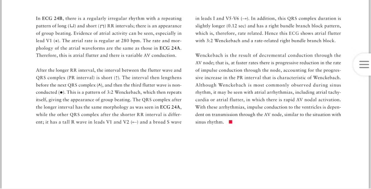 「读心有术」168期：房扑也能文氏传导，你听说过吗？