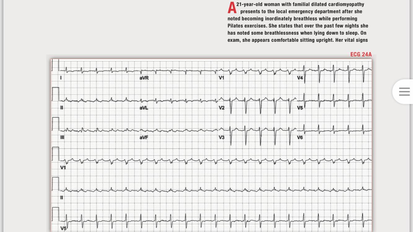 「读心有术」168期：房扑也能文氏传导，你听说过吗？