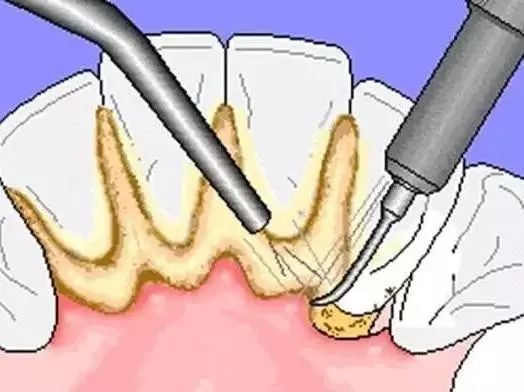 爱牙口腔日,爱牙日华西口腔医院