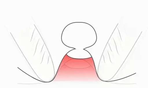 战痘多年如何重回颜值巅峰,战痘逆袭之路