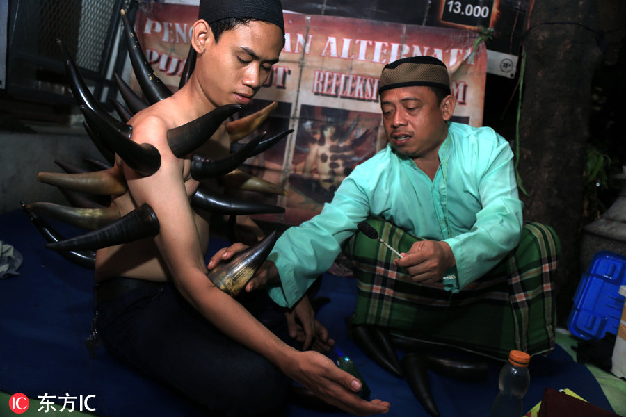 印尼治腰腿疼的药,大连牛角拔火罐疗法