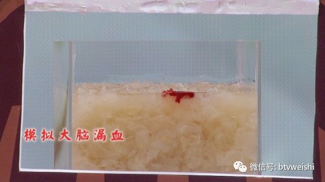 养生堂揭秘大脑的神秘物质,养生堂最新视频