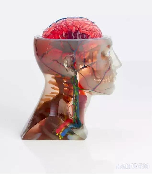 粒子植入治疗肿瘤原理,3d打印肿瘤模型使癌症患者康复