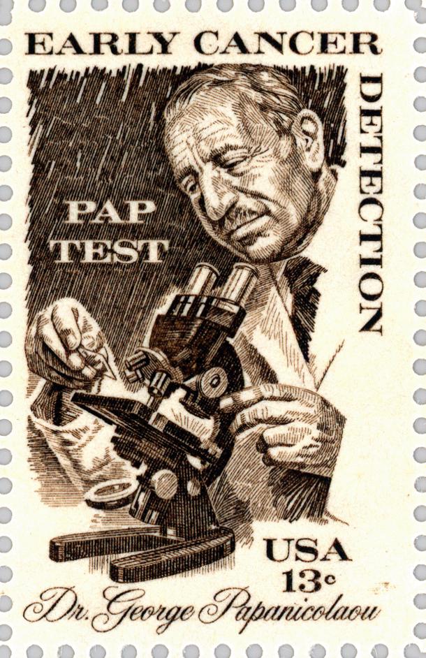 宫颈刮片多久可以拿报告,宫颈刮片图片报告单