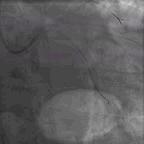 典型病例及处理方法,典型病例分析及治疗方法
