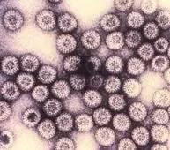 狂犬病毒vs埃博拉病毒,埃博拉病毒和狂犬病毒哪个更厉害