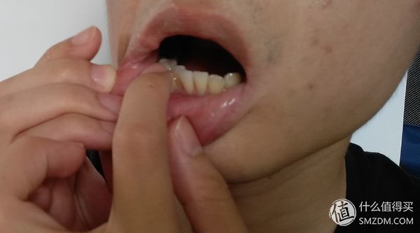 家庭医护小药箱,家庭急救小型药箱