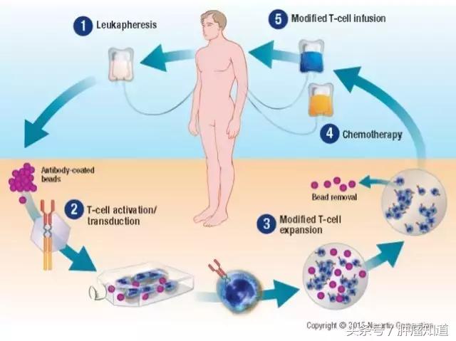 120万cart-t疗法利弊分析,一文读懂cart细胞免疫疗法